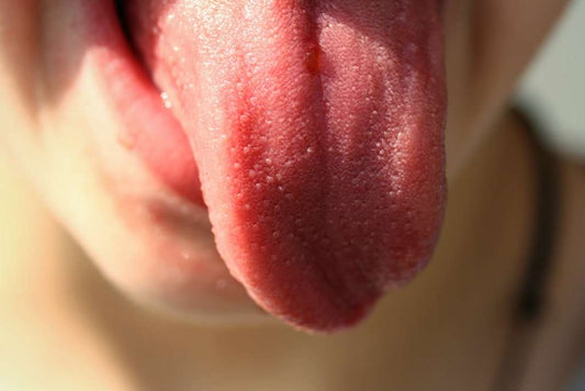 What does your tongue say about you?